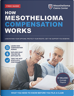 Free Mesothelioma Compensation Guide Booklet